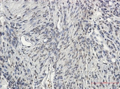 Immunohistochemistry-Paraffin: Synapsin II Antibody (S07-0I5) [NBP3-19920] - Immunohistochemistry of Synapsin II in paraffin-embedded Human Brain using NBP3-19920 at dilution 1/50