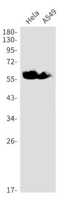 Western Blot: Synapsin II Antibody (S07-0I5) [NBP3-19920] - Western blot detection of Synapsin II in Hela, A549 cell lysates using NBP3-19920 (1:1000 diluted). Predicted band size: 63kDa. Observed band size: 63kDa.