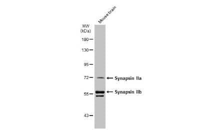 Western Blot: Synapsin II Antibody [NBP3-13443] - Mouse tissue extract (30 ug) was separated by 7.5% SDS-PAGE, and the membrane was blotted with Synapsin II antibody (NBP3-13443) diluted at 1:2500. The HRP-conjugated anti-rabbit IgG antibody (NBP2-19301) was used to detect the primary antibody.