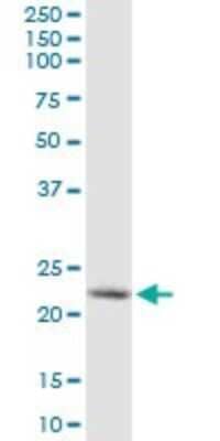 Western Blot: Synaptobrevin homolog YKT6 Antibody (1F8) [H00010652-M03] - Analysis of YKT6 expression in MCF-7.