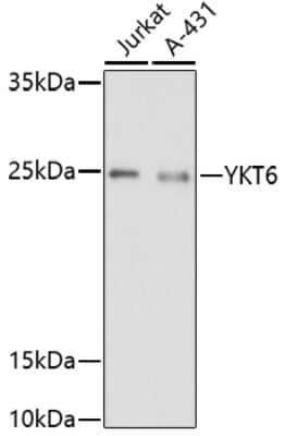 Western Blot: Synaptobrevin homolog YKT6 Antibody [NBP2-94847] - Analysis of extracts of various cell lines, using Synaptobrevin homolog YKT6 at 1:1000 dilution. Secondary antibody: HRP Goat Anti-Rabbit IgG (H+L) at 1:10000 dilution. Lysates/proteins: 25ug per lane. Blocking buffer: 3% nonfat dry milk in TBST. Detection: ECL Basic Kit . Exposure time: 3min.