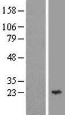 Western Blot: Synaptobrevin homolog YKT6 Overexpression Lysate (Adult Normal) [NBL1-17936] Left-Empty vector transfected control cell lysate (HEK293 cell lysate); Right -Over-expression Lysate for Synaptobrevin homolog YKT6.