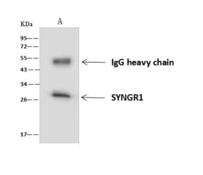 Immunoprecipitation: Synaptogyrin 1 Antibody [NBP3-06294] - SYNGR1 was immunoprecipitated using:Lane A: 0.5 mg 293T Whole Cell Lysate4 uL anti-SYNGR1 rabbit polyclonal antibody and 60 ug of Immunomagnetic beads Protein AG.Primary antibody:Anti-SYNGR1 rabbit polyclonal antibody, at 1:100 dilution Secondary antibody:Goat Anti-Rabbit IgG (H+L) HRP at 110000 dilutionDeveloped using the ECL technique.Performed under reducing conditions.Predicted band size: 25 kDaObserved band size: 28 kDa