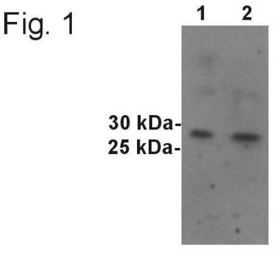 Western Blot: Synaptogyrin 1 Antibody [NB100-74544] - Analysis of rat brain.