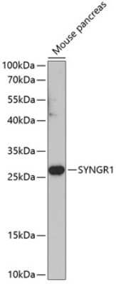 Western Blot: Synaptogyrin 1 Antibody [NBP2-93908] - Analysis of extracts of mouse pancreas, using Synaptogyrin 1 .Exposure time: 90s.