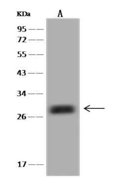 Western Blot: Synaptogyrin 1 Antibody [NBP3-06294] - Anti-SYNGR1 rabbit polyclonal antibody at 1:500 dilutionLane A: HeLa Whole Cell LysateLane B: 293T Whole Cell LysateLane C: Jurkat Whole Cell LysateLysates/proteins at 30 ug per lane.SecondaryGoat Anti-Rabbit IgG (H+L) HRP at 110000 dilution.Developed using the ECL technique.Performed under reducing conditions.Predicted band size:25 kDaObserved band size:27 kDa