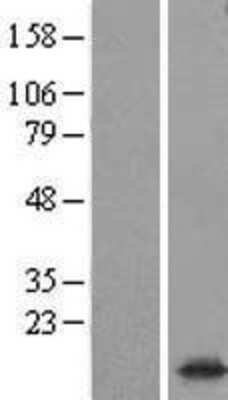 Western Blot: Synaptogyrin 1 Overexpression Lysate (Adult Normal) [NBL1-16640] Left-Empty vector transfected control cell lysate (HEK293 cell lysate); Right -Over-expression Lysate for Synaptogyrin 1.