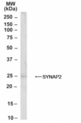 Western Blot: Synaptogyrin 2 Antibody [NB100-1490] - Analysis of Human Muscle lysate (35ug protein in RIPA buffer) using this antibody at 0.3 ug/ml. Primary incubation was 1 hour. Detected by chemiluminescence.