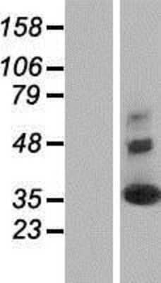 Western Blot: Synaptogyrin 2 Overexpression Lysate (Adult Normal) [NBP2-10535] Left-Empty vector transfected control cell lysate (HEK293 cell lysate); Right -Over-expression Lysate for Synaptogyrin 2.
