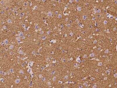 Immunohistochemistry-Paraffin: Synaptogyrin 3 Antibody [NBP3-06229] - Immunochemical staining of human SYNGR3 in human brain with rabbit polyclonal antibody at 1:100 dilution, formalin-fixed paraffin embedded sections.