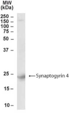 Western Blot: Synaptogyrin 4 Antibody [NB300-984] - Western blot analysis of Synaptogyrin 4 in human brain lysate using NB300-984 at 0.01 ug/ ml.