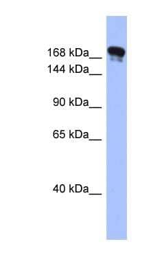 Western Blot: Synaptojanin 1 Antibody [NBP1-57368] - Human Stomach, concentration 0.2-1 ug/ml.