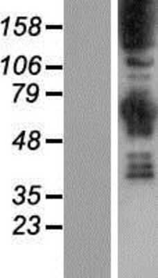 Western Blot: Synaptojanin 1 Overexpression Lysate (Adult Normal) [NBP2-04553] Left-Empty vector transfected control cell lysate (HEK293 cell lysate); Right -Over-expression Lysate for Synaptojanin 1.