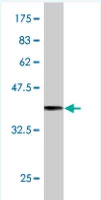 Western Blot: Synaptojanin 2 Antibody (2B11) [H00008871-M03] - Detection against Immunogen (36.74 KDa) .