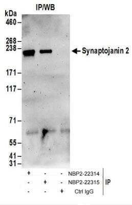 <b>Biological Strategies Validation. </b>Immunoprecipitation: Synaptojanin 2 Antibody [NBP2-22314] - Whole cell lysate (1 mg for IP; 20% of IP loaded) from 293T cells.  Antibodies:  NBP2-22314 used for IP at 6 ug/mg lysate.  Synaptojanin 2 was also immunoprecipitated by rabbit anti-Synaptojanin 2 antibody NBP2-22315.  For blotting immunoprecipitated Synaptojanin 2, NBP2-22314 was used at 1 ug/ml.  Detection: Chemiluminescence with an exposure time of 3 minutes.