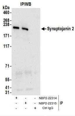 <b>Biological Strategies Validation. </b>Immunoprecipitation: Synaptojanin 2 Antibody [NBP2-22315] - Whole cell lysate (1 mg for IP; 20% of IP loaded) from 293T cells.  Antibodies:  NBP2-22315 used for IP at 6 ug/mg lysate.  Synaptojanin 2 was also immunoprecipitated by rabbit anti-Synaptojanin 2 antibody NBP2-22314.  For blotting immunoprecipitated Synaptojanin 2, NBP2-22315 was used at 1 ug/ml.  Detection: Chemiluminescence with an exposure time of 30 seconds.