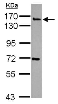 Western Blot: Synaptojanin 2 Antibody [NBP2-20543] - Sample (30 ug of whole cell lysate) A: NT2D1 7. 5% SDS PAGE gel, diluted at 1:1000.