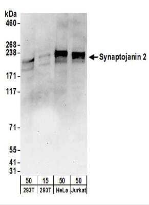 Western Blot: Synaptojanin 2 Antibody [NBP2-22314] - Whole cell lysate from 293T (15 and 50 ug), HeLa (50 ug), and Jurkat (50 ug) cells. NBP2-22314 used for WB at 1 ug/ml.  Detection: Chemiluminescence with an exposure time of 30 seconds.