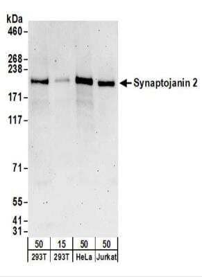 Western Blot: Synaptojanin 2 Antibody [NBP2-22315] - Whole cell lysate from 293T (15 and 50 ug), HeLa (50 ug), and Jurkat (50 ug) cells. NBP2-22315 used for WB at 0.1 ug/ml.  Detection: Chemiluminescence with an exposure time of 3 minutes.