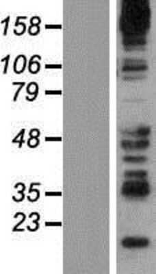 Western Blot: Synaptojanin 2 Overexpression Lysate (Adult Normal) [NBP2-10552] Left-Empty vector transfected control cell lysate (HEK293 cell lysate); Right -Over-expression Lysate for Synaptojanin 2.