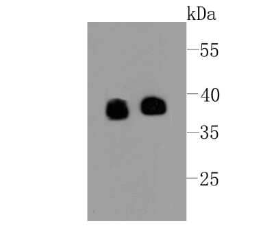 Western Blot: Synaptophysin Antibody (SJ26-85) [NBP2-67173] - Analysis of Synaptophysin on different cell lysates using anti-Synaptophysin at 1/500 dilution. Positive control: Lane 1: Human brain Lane 2: PC-12