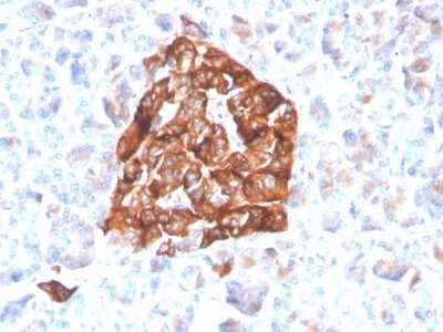 Immunohistochemistry-Paraffin: Synaptophysin Antibody (SYP/4503R) [NBP3-07325] - Formalin-fixed, paraffin-embedded human pancreas stained with Synaptophysin Recombinant Rabbit Monoclonal Antibody (SYP/4503R).