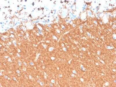 Immunohistochemistry-Paraffin: Synaptophysin Antibody (SYP/4503R) [NBP3-07325] - Formalin-fixed, paraffin-embedded human brain stained with Synaptophysin Antibody (SYP/4503R).