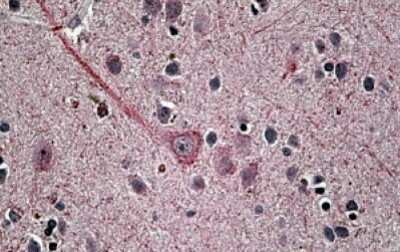 Immunohistochemistry-Paraffin: Synaptotagmin-1 Antibody [NBP1-51925] - NBP1-51925 (3.8ug/ml) staining of paraffin embedded Human Brain. Steamed antigen retrieval with citrate buffer pH 6, AP-staining.