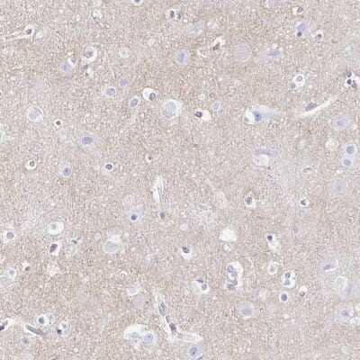 Immunohistochemistry-Paraffin: Synaptotagmin 1 Antibody [NBP2-34215] - Staining of human cerebral cortex shows high expression.
