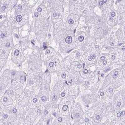 Immunohistochemistry-Paraffin: Synaptotagmin 1 Antibody [NBP2-34215] - Staining of human liver.