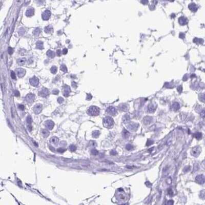 Immunohistochemistry-Paraffin: Synaptotagmin 1 Antibody [NBP2-34215] - Staining of human testis.