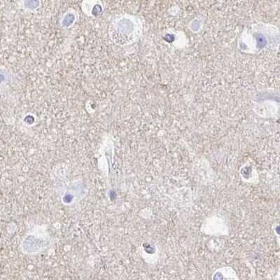 Immunohistochemistry-Paraffin: Synaptotagmin 1 Antibody [NBP2-34215] - Staining of human cerebral cortex using Anti-SYT1 antibody NBP2-34215.