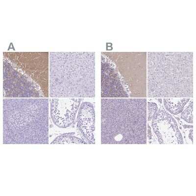 <b>Independent Antibodies Validation and Orthogonal Strategies Validation.</b>Immunohistochemistry-Paraffin: Synaptotagmin 1 Antibody [NBP2-34215] - Staining of human cerebellum, liver, pancreas and testis using Anti-Synaptotagmin 1 antibody NBP2-34215 (A) shows similar protein distribution across tissues to independent antibody NBP1-87362 (B).
