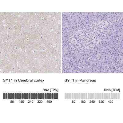 Immunohistochemistry-Paraffin Synaptotagmin 1 Antibody