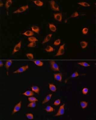 Immunocytochemistry/Immunofluorescence: Synaptotagmin 12 Antibody [NBP3-15537] - Immunofluorescence analysis of L929 cells using Synaptotagmin 12 antibody (NBP3-15537) at dilution of 1:100. Blue: DAPI for nuclear staining.