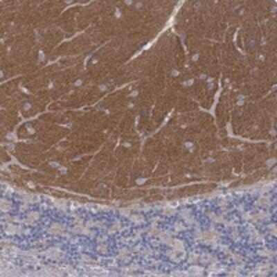 Immunohistochemistry-Paraffin: Synaptotagmin 12 Antibody [NBP3-17315] - Staining of human cerebellum shows moderate positivity in neuropil.