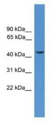 Western Blot: Synaptotagmin 12 Antibody [NBP1-69103] - PANC1 Cell Lysate 1ug/ml  Gel Concentration 12%