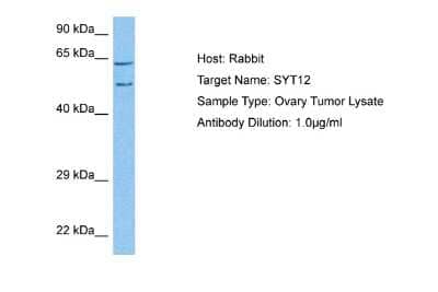 Western Blot: Synaptotagmin 12 Antibody [NBP2-88392] - Host: Rabbit. Target Name: SYT12. Sample Tissue: Human Ovary Tumor lysates. Antibody Dilution: 1ug/ml