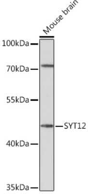 Western Blot: Synaptotagmin 12 Antibody [NBP3-15537] - Analysis of extracts of Mouse brain, using Synaptotagmin 12 Rabbit pAb (NBP3-15537) at 1:1000 dilution. Secondary antibody: HRP Goat Anti-Rabbit IgG (H+L) at 1:10000 dilution. Lysates/proteins: 25ug per lane. Blocking buffer: 3% nonfat dry milk in TBST. Detection: ECL Basic Kit. Exposure time: 3min.