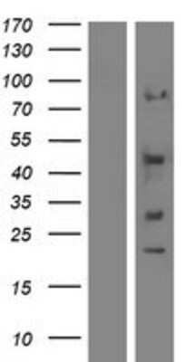 Western Blot: Synaptotagmin 12 Overexpression Lysate (Adult Normal) [NBP2-05003] Left-Empty vector transfected control cell lysate (HEK293 cell lysate); Right -Over-expression Lysate for Synaptotagmin 12.