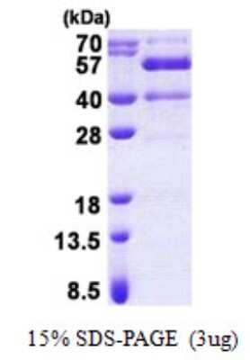 SDS-Page: Recombinant Human Synaptotagmin 13 Protein [NBP2-22839]