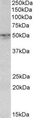 Western Blot: Synaptotagmin 2 Antibody [NBP1-68859] - NBP1-68859 (0.1ug/ml) staining of Mouse Lung lysate (35ug protein in RIPA buffer). Primary incubation was 1 hour. Detected by chemiluminescence.