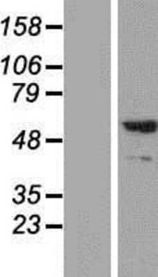 Western Blot: Synaptotagmin 2 Overexpression Lysate (Adult Normal) [NBP2-05032] Left-Empty vector transfected control cell lysate (HEK293 cell lysate); Right -Over-expression Lysate for Synaptotagmin 2.