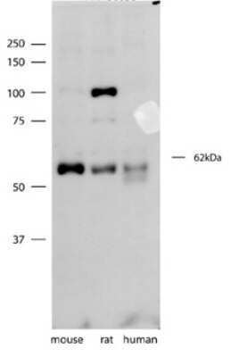 Western Blot: Synaptotagmin 3 Antibody [NBP1-59689] - SYT3 antibody - N-terminal region validated by WB using mouse, rat, and human brain lysates at 1ug/ml.