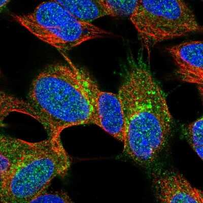 Immunocytochemistry/Immunofluorescence: Synaptotagmin 4 Antibody [NBP2-13408] - Immunofluorescent staining of human cell line SH-SY5Y shows localization to plasma membrane & vesicles.