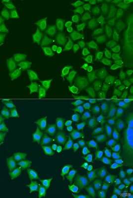 Immunocytochemistry/Immunofluorescence: Synaptotagmin 4 Antibody [NBP2-93411] - Analysis of U2OS cells using Synaptotagmin 4 at dilution of 1:100. Blue: DAPI for nuclear staining.