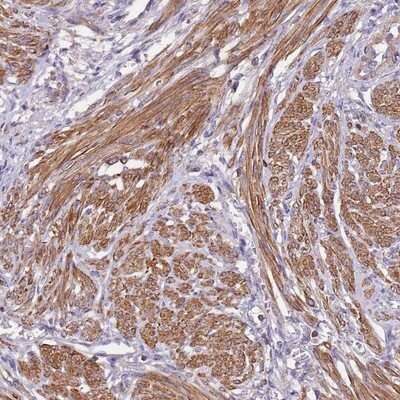 Immunohistochemistry-Paraffin: Synaptotagmin 4 Antibody [NBP2-13408] - Staining of human smooth muscle shows moderate cytoplasmic positivity in muscle cells.