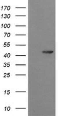 Western Blot Synaptotagmin 4 Antibody (OTI4H3) - Azide and BSA Free