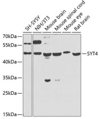 Western Blot: Synaptotagmin 4 Antibody [NBP2-93411] - Analysis of extracts of various cell lines, using Synaptotagmin 4 at 1:1000 dilution. Secondary antibody: HRP Goat Anti-Rabbit IgG (H+L) at 1:10000 dilution. Lysates/proteins: 25ug per lane. Blocking buffer: 3% nonfat dry milk in TBST. Detection: ECL Basic Kit . Exposure time: 90s.