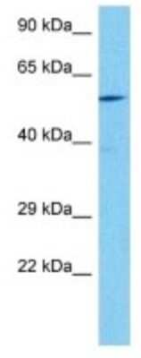 Western Blot: Synaptotagmin 4 Antibody [NBP3-10126] - Western blot analysis of Synaptotagmin 4 in Mouse Skeletal Muscle lysates. Antibody dilution at 1ug/ml